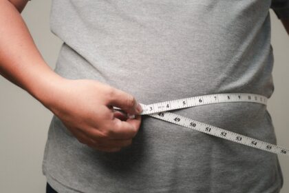 Estudio revela que la obesidad podría afectar a 126 millones en EE.UU. en 2035