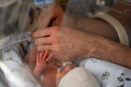 La donación de sangre de cordón umbilical se abre camino para tratar la anemia en bebés muy prematuros | Salud y bienestar