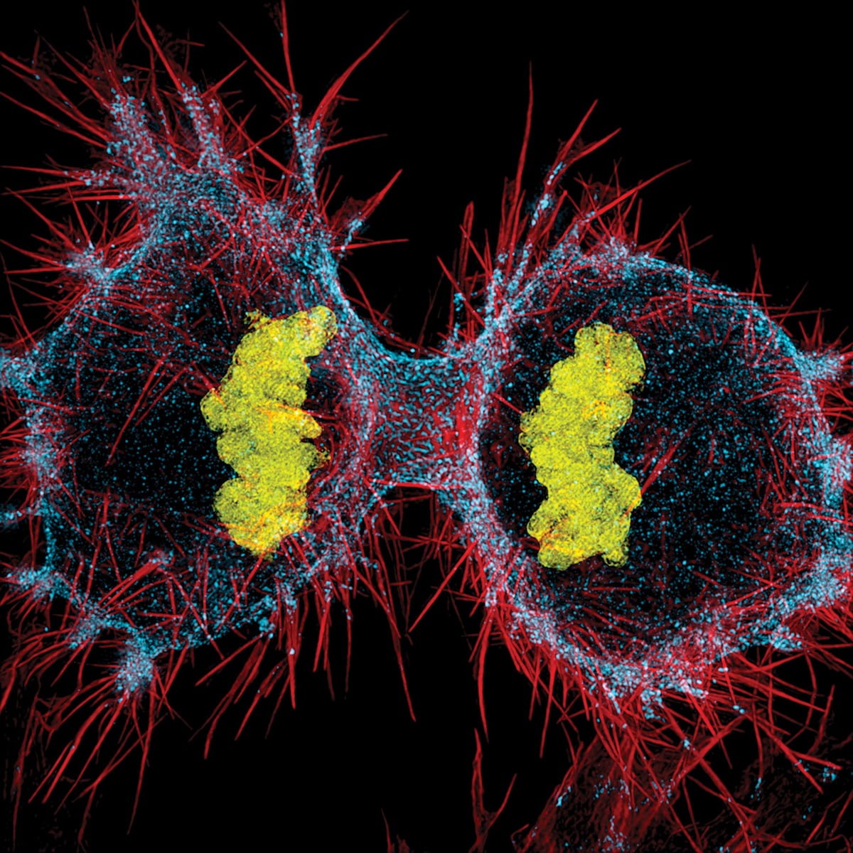 Unos virus primitivos que se propagan por el genoma humano, nuevo motor del cáncer | Salud y bienestar