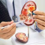 Estos dos alimentos dañan tus riñones y no lo sabías: advierten médicos