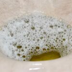 Cómo es la orina espumosa y cuándo deberías preocuparte