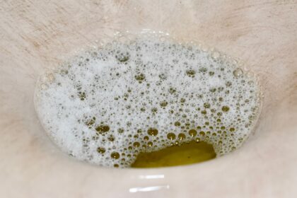 Cómo es la orina espumosa y cuándo deberías preocuparte