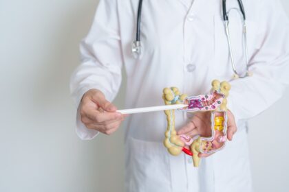 El cáncer colorrectal no es solo cosa de viejos