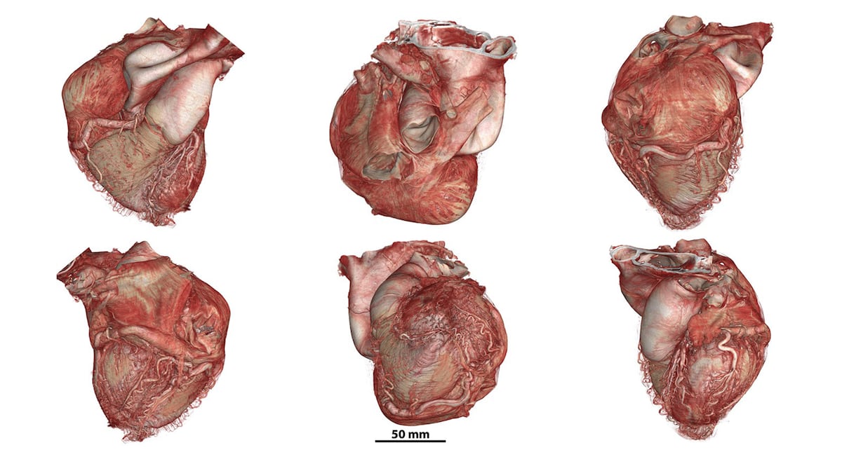 Un nuevo atlas interactivo permite ver el cuerpo humano como nunca antes | Salud y bienestar