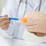 La historia de un joven que sobrevivió a un tumor tras 10 años de diagnósticos erróneos