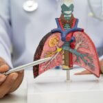 Líquido en los pulmones: 4 señales que debes atender de inmediato