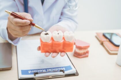 ¿Puedo morir por una infección dental? Médicos advierten