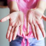 Mano con palmas enrojecidas y dedos en forma de palillo de tambor, señales de hígado enfermo